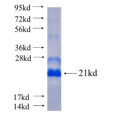 Recombinant human FOXB1 SDS-PAGE