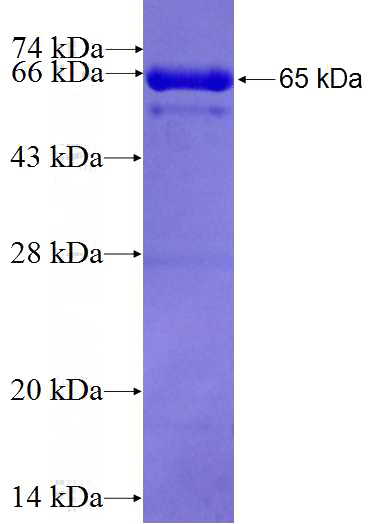 Recombinant Human ANAPC5 SDS-PAGE