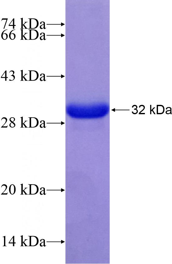 Recombinant Human IVL SDS-PAGE
