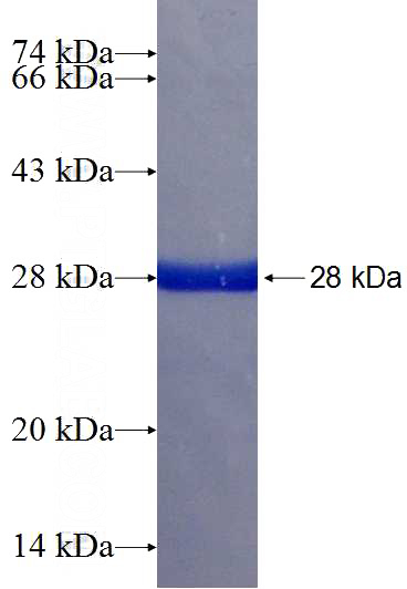 Recombinant Human SPAST SDS-PAGE