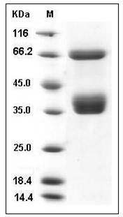 Human CD136 / MST1R Protein (His Tag) SDS-PAGE