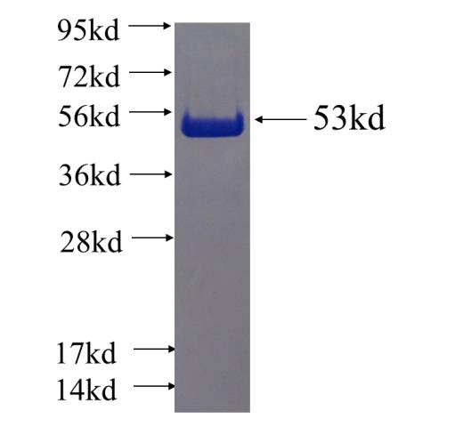 Recombinant human TXNDC9 SDS-PAGE