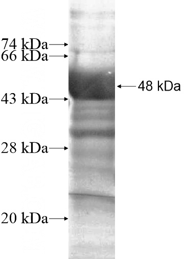 Recombinant Human HERPUD2 SDS-PAGE