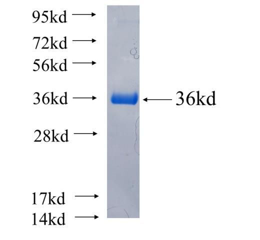 Recombinant human PDE6B SDS-PAGE