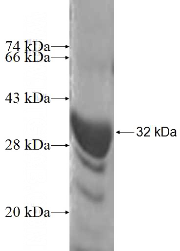 Recombinant Human SPAG7 SDS-PAGE