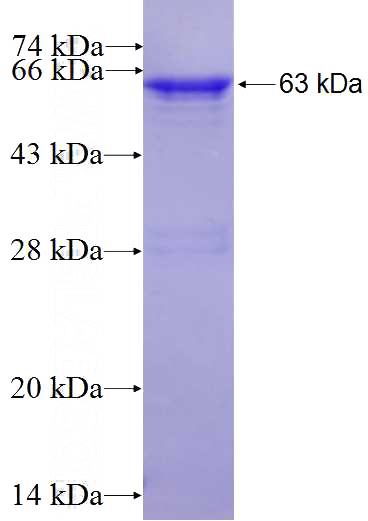 Recombinant Human MED23 SDS-PAGE