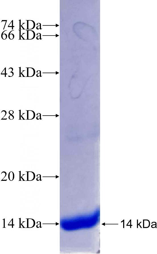 Recombinant Human filamin-c SDS-PAGE