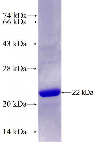 Recombinant Human PTPRD SDS-PAGE