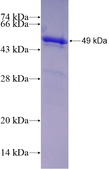 Recombinant Human CTBP1 SDS-PAGE