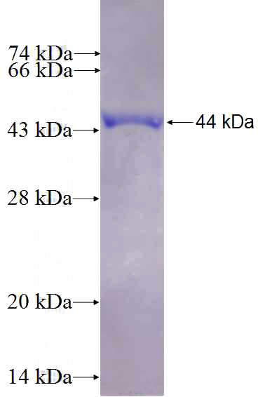 Recombinant Human ATXN7 SDS-PAGE