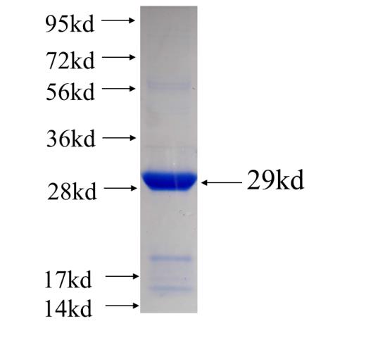 Recombinant human GOLPH3 SDS-PAGE