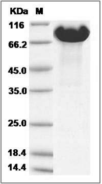 Human APLP1 / Amyloid-like protein 1 Protein (His Tag) SDS-PAGE