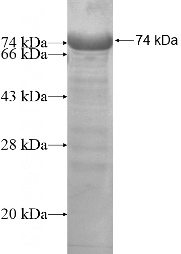Recombinant Human KIAA1430 SDS-PAGE