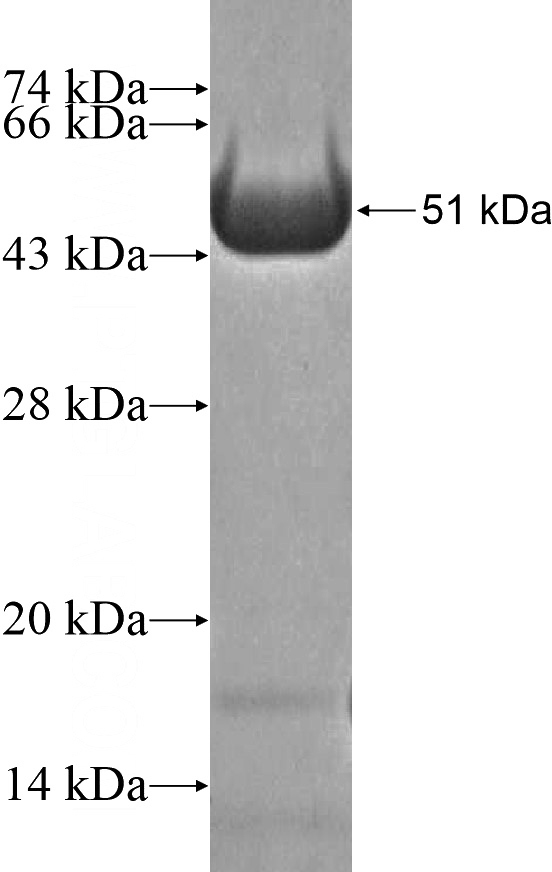 Recombinant Human ARHGAP27 SDS-PAGE