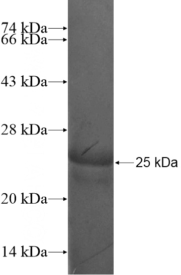 Recombinant Human RAX SDS-PAGE