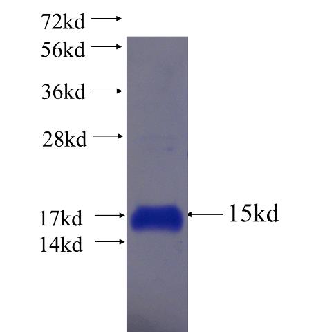 Recombinant human HOXA2 SDS-PAGE