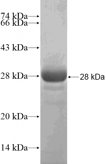 Recombinant Human DMGDH SDS-PAGE