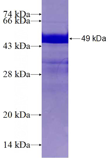Recombinant Human DNAJB6 SDS-PAGE