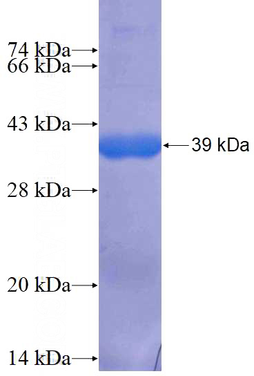 Recombinant Human USP3 SDS-PAGE
