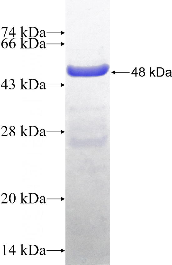Recombinant Human PSMB9 SDS-PAGE