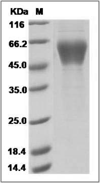 Human KREMEN1 Protein (His Tag) SDS-PAGE