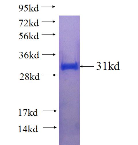Recombinant human EIF4EBP3 SDS-PAGE