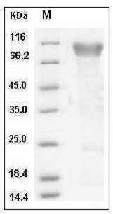 Human BLNK / Ly-57 / SLP-65 Protein (His Tag) SDS-PAGE