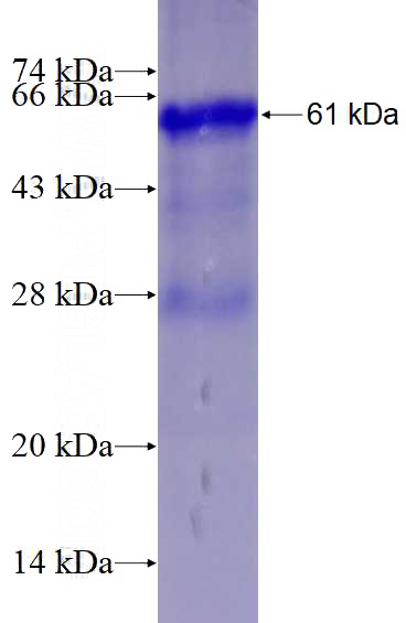 Recombinant Human SPATA7 SDS-PAGE