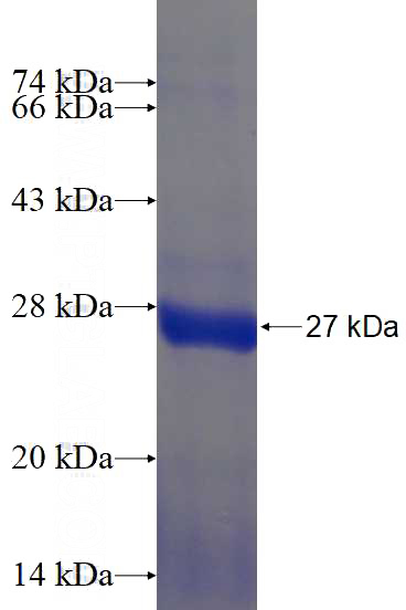 Recombinant Human F8 SDS-PAGE