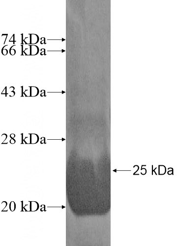 Recombinant Human KCTD11 SDS-PAGE