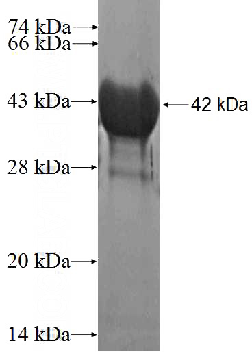 Recombinant Human AHNAK SDS-PAGE