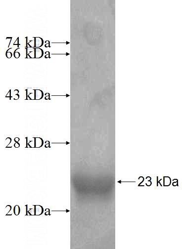 Recombinant Human CALML4 SDS-PAGE