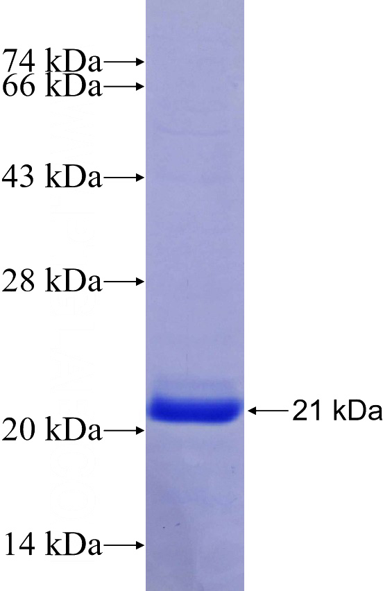 Recombinant Human RPS18 SDS-PAGE