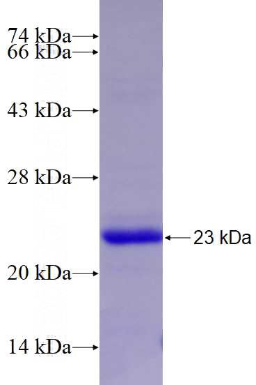 Recombinant Human RGS10 SDS-PAGE