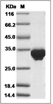 Human BIN2 / BRAP-1 Protein (His Tag) SDS-PAGE