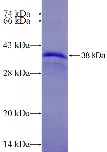 Recombinant Human ZFX SDS-PAGE