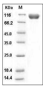 Mouse IL-18R1 Protein (His & Fc Tag) SDS-PAGE