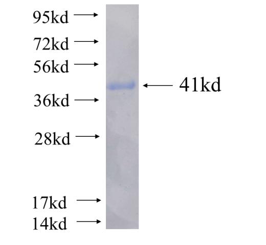 Recombinant human ARAP3 SDS-PAGE
