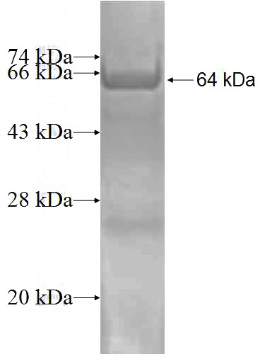 Recombinant Human PSMD5 SDS-PAGE