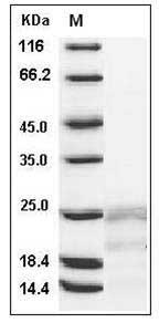 Human IFN-gamma / IFNG / γ-IFN Protein SDS-PAGE