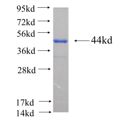 Recombinant human ECT2 SDS-PAGE