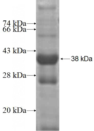 Recombinant Human ATP6V1B1 SDS-PAGE