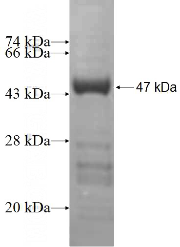 Recombinant Human RPL18A SDS-PAGE