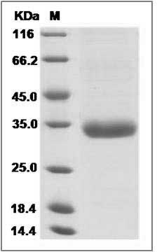 Mouse Angiopoietin-2 / ANG2 / ANGPT2 Protein (His Tag) SDS-PAGE