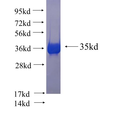 Recombinant human MMP23B SDS-PAGE