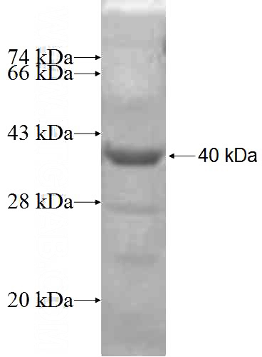 Recombinant Human C9orf78 SDS-PAGE