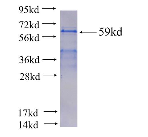Recombinant human SORBS1 SDS-PAGE