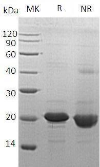 Human SOD1 (His tag) recombinant protein
