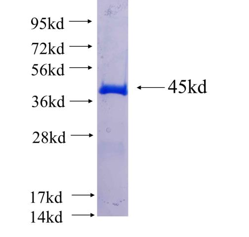Recombinant human KIAA0226 SDS-PAGE