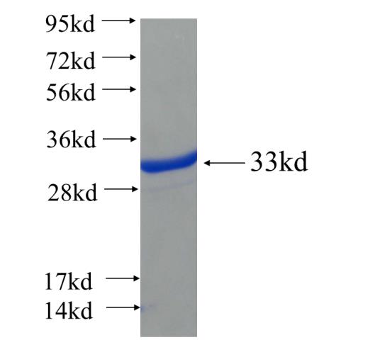 Recombinant human ANKRD13B SDS-PAGE
